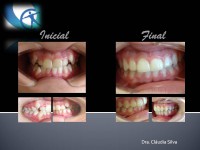 /album/casos-clinicos1/mar-gimar%c3%a3es-jpg2/